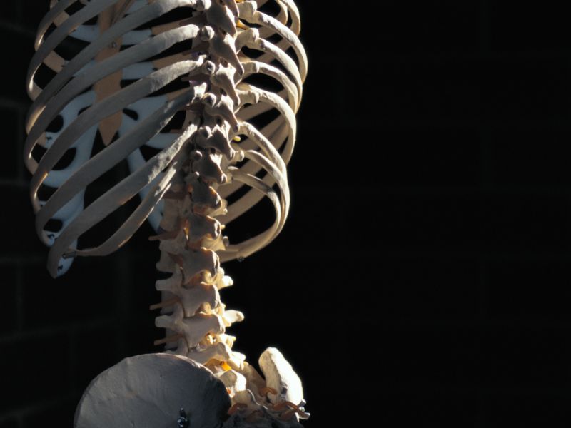 How to Keep Your Bones Strong and Prevent Fractures