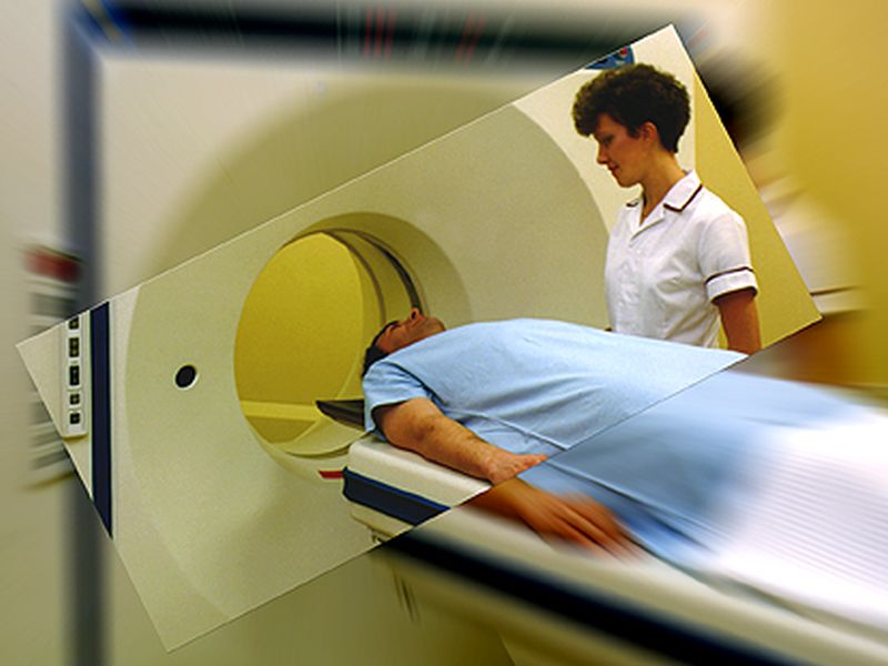 Lung Cancer Screening Can Detect Other Smoking Ills